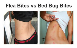 Flea Bites vs Bed Bug Bites - What is the Difference?