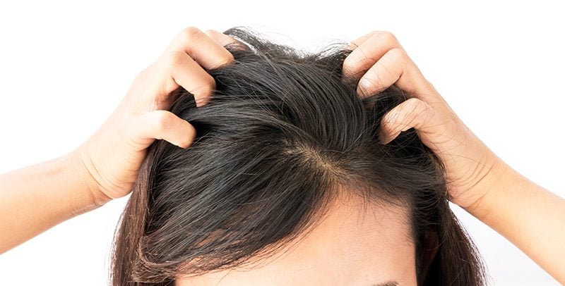 will fleas stay in human hair
